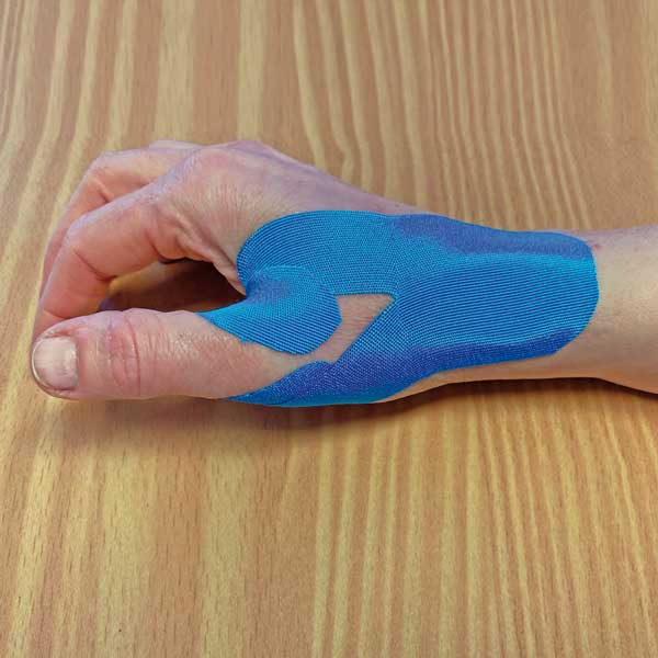 Ergotherapie Ritzarthrose München